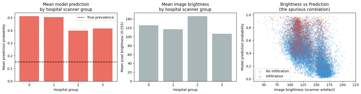 ../_images/example_notebooks_gcm_chest_xray_causal_inference_13_0.png