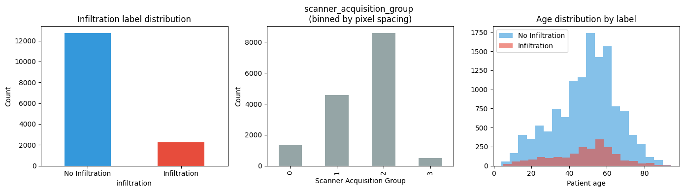 ../_images/example_notebooks_gcm_chest_xray_causal_inference_7_1.png